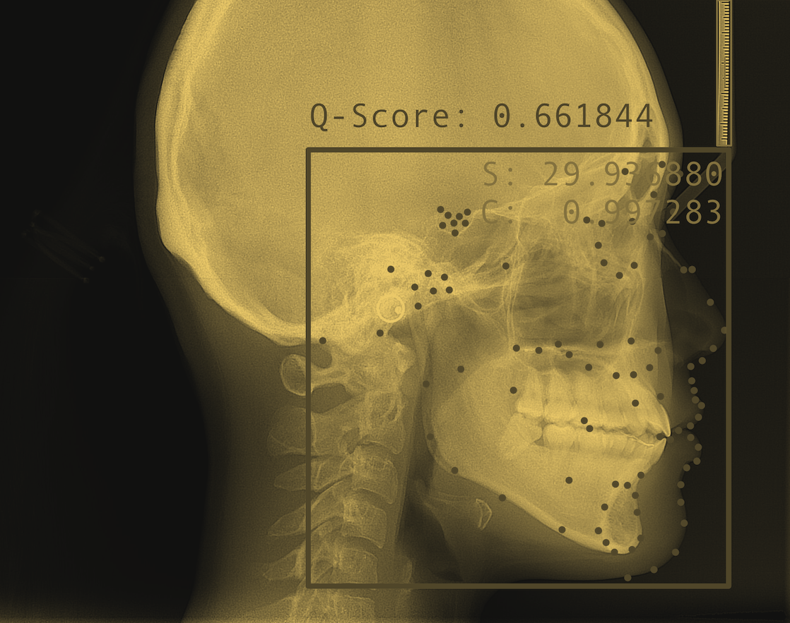 X-ray analysis case frame